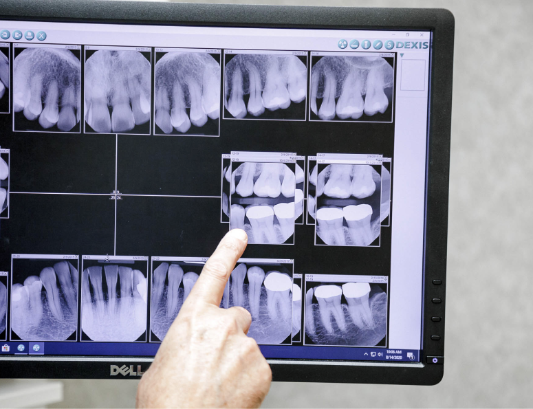 computer monitor with dental x-ray image