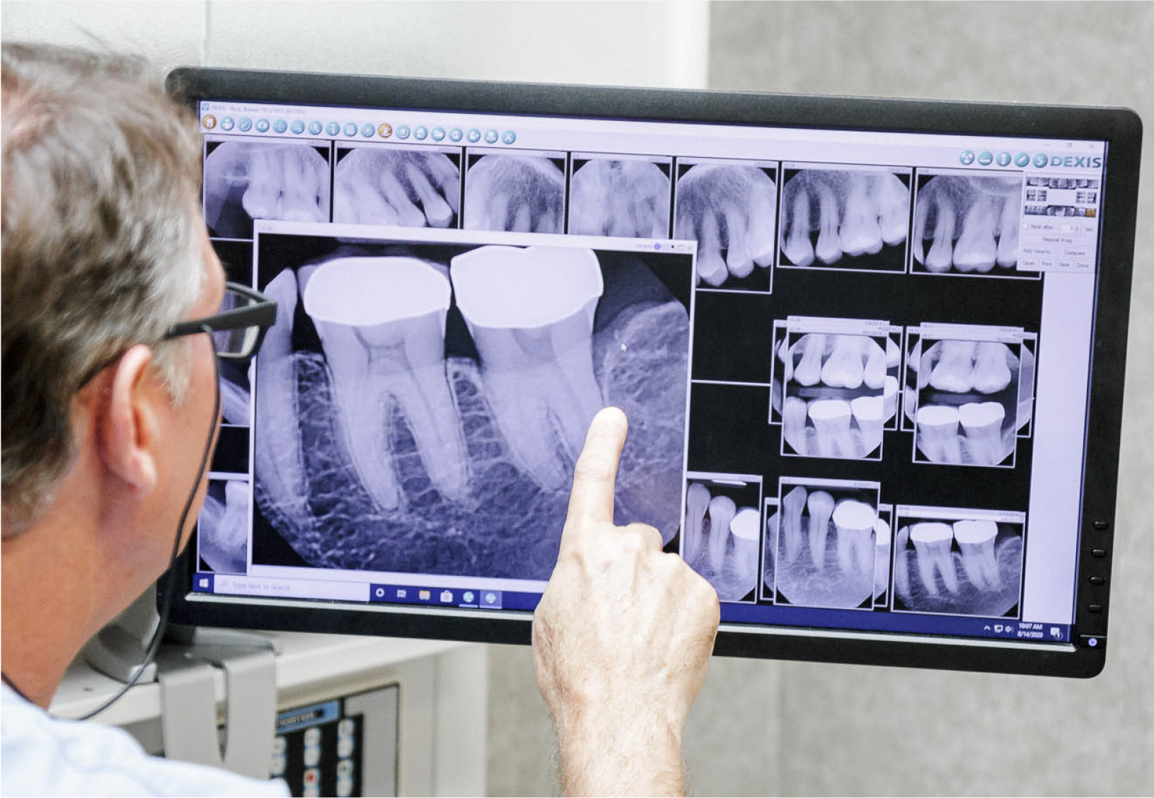 Dr. Seale reviewing dental x-ray image on a computer monitor