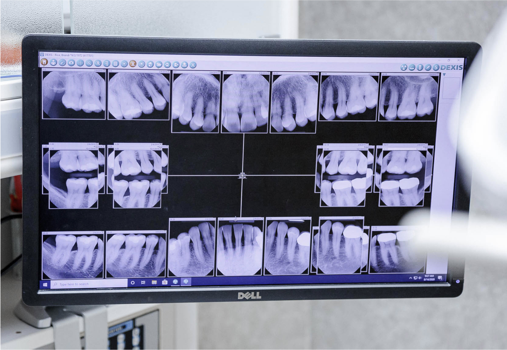 computer monitor with dental x-ray image